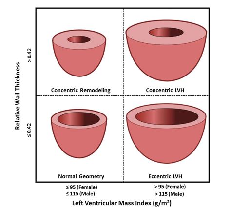 lv relative wall thickness|left ventricle increased wall thickness.